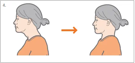 Chin tucks (neck retraction)