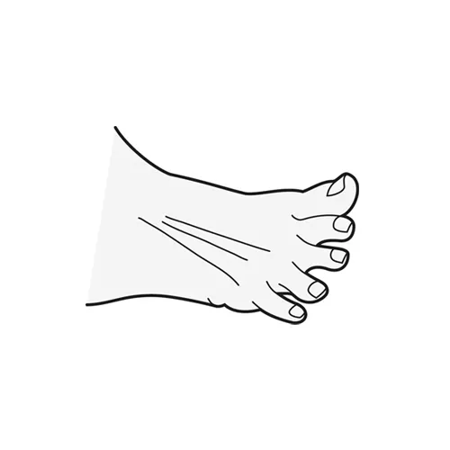Toe spread