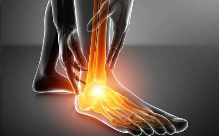 Ankle Stiffness